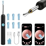 Wireless Ear Wax Removal Tool Camera, Smart Visual Ear Cleaner Otoscope with 1080P HD Waterproof Lens & 6 LED Lights, USB-C Fast Charge, 360° Rotation Ear Scope for iOS & Android, 6 Ear Tips.(Black)