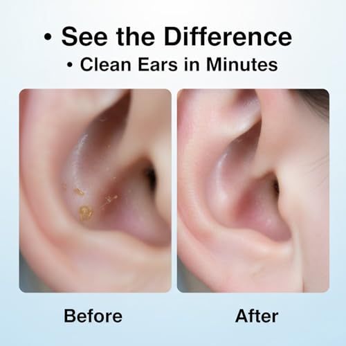 Image of Signamio Ear Cleaner Tool with Camera - HD Ear Wax Removal Tool with WiFi Connection, LED Light Endoscope Ear Cleaning Tool Kit for Safe and Effective Cleaning
