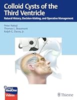 Colloid Cysts of the Third Ventricle: Natural History, Decision-Making, and Operative Management 168420156X Book Cover
