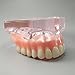 Dental Model Overdenture Upper Teeth 4 Implants Demo for Teaching and Studying