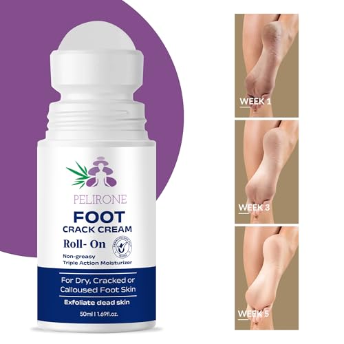 PELIRONE 20% Urea Foot Cream Roll On 50ml | For Dry & Cracked Heels | With 2% Lactic Acid, Olive Oil & Vitamin E | Helps Repair and Moisturise Cracked Heels 2 41E9VT5MluL. SL500