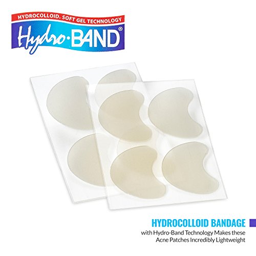 Medca Acne Care Pimple Patch Absorbing Cover - Cheek Size Acne Spot Treatment Hydrocolloid Bandage Face & Skin Spot Patch Conceals Acne, Reduces Pimples And Blackheads #TOP7