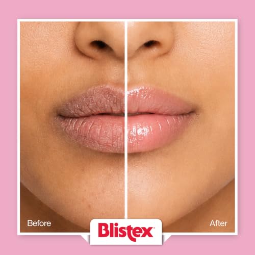 Image of Blistex Berry Lip Balm, 4.25 g | Moisturising Lip Balm for Dry & Chapped Lips | Daily Lip Care & Protection | Berry Flavour