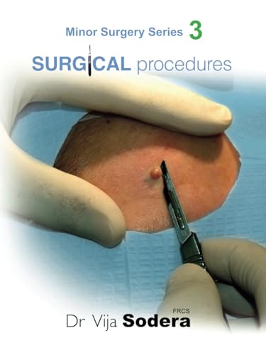 Surgical Procedures (Minor Surgery Series)