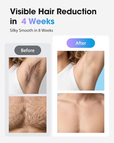 Haarlosy IPL Laser Hair Removal Device for Women and Men with Ice Cooling Painless Salon Quality Results at Home, Lazer Hair Remover for Face Bikini Line Body, 5 Levels, 999,900 Flash Light, Rose