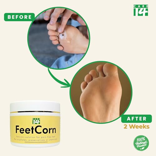 Image of FeetCorn Gel| Relieves Corn Pain, Reduces Inflammation, Hydrates & Promotes Foot Health| 100% Herbal| (100gms)
