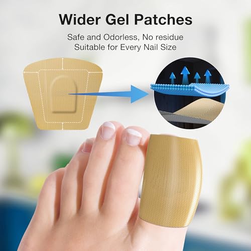 Toenail Fungus Treatment Extra Strength – 30mL Liquid Solution and 20 Fungal Nail Patches for Thick, Brittle or Discolored Nails – Gentle Repair for Damaged Toenails and Fingers–Dual-Action Treatment