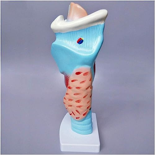 Modèle anatomique du larynx pour simplifier l'explication des pathologies