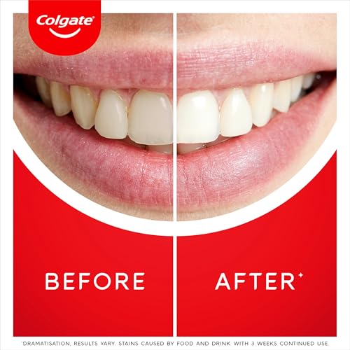 Colgate Max White Ultra Active Foam Toothpaste, at Home Whitening Toothpaste Clinically Proven Whiter Teeth in 3 Days, Toothpaste Multipack, 2 Pack, 75ml Tubes