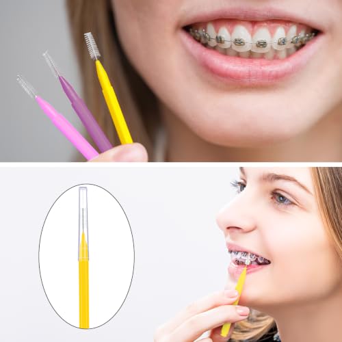 Image of Patelai 100 Pieces Braces Dental Brush for Cleaner Interdental Toothpick Dental Tooth Flossing Head Oral Hygiene Flosser Toothpick Cleaners Tooth Tool(Pink,Purple, Yellow,Mixed Size)