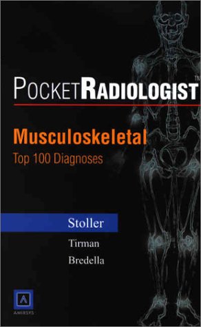 PocketRadiologist - Musculoskeletal: Top 100 Diagnoses