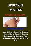  Stretch Marks Permanent Removal: Your Skincare Complete Guide on Stretch Marks Common Causes, Prevention and Treatment Plus Modern ways of removing all Acne Scar