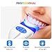 Vertical Teeth Whitening Light, 36W Dental Mobile 10 LED Cold Light Lamp for Teeth Whitening, Adopting Blue Light to Enhance Deep Whitening of Whitening Agent