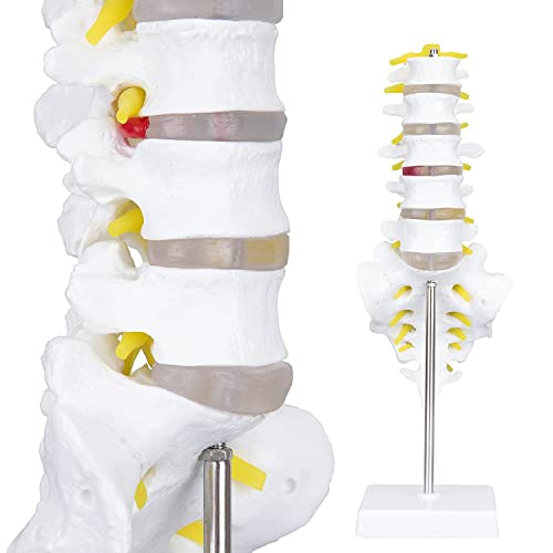 Image of Life Size Lumbar Vertebrae Sacrum Coccyx & Nerves Anatomical Spinal Column for Chiropractor, Medical Students, Teaching & Demonstration