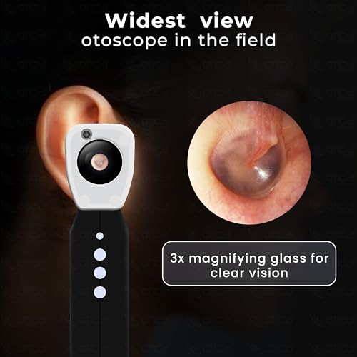 Image of OTICA 3.7V Professional Diagnostic Pocket LED Otoscope | Rechargeable In-Built 3500mAh Battery | Type-C Charging | Adjustable Intensity | 10 Reusable Specula + Spare Glass | 11707 - Black