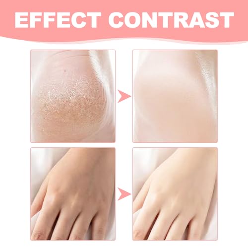 2 Stück Fusscreme Sehr Trockene Füsse Hornhaut Foot Cream für Rissige Fersen und Trockene Haut für Fersenbehandlung Knie Ellbogen und Hände Feuchtigkeitsspendende – Bild 6