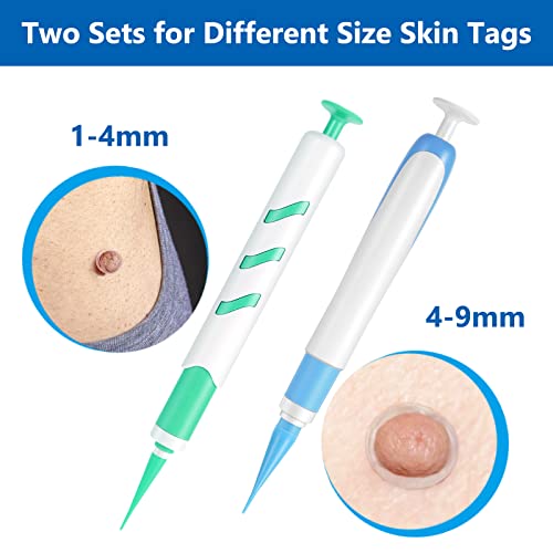 Warzen Entfernungs-Set, Auto Tool Kit Skin Tag Remover, Schmerzfrei Automatisches Stiftset Hautmarken Entferner… – Ansicht 3