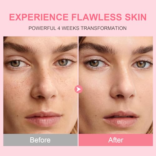 AVJONE Niacinamide Serum 50% Off with Code 50RA3ZWS