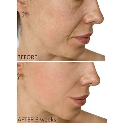 Eylleaf Hyaluronic Acid Cream - Facial Moisturizer with Vitamin C for Dry and Mature Skin 50ml - Image 3