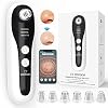 Mee-eterverwijderaar VITCOCO blackhead remover met Camera, 500W Pixelverwijderaar, Zichtbare 10-Voudige Microscoop, WIFI…