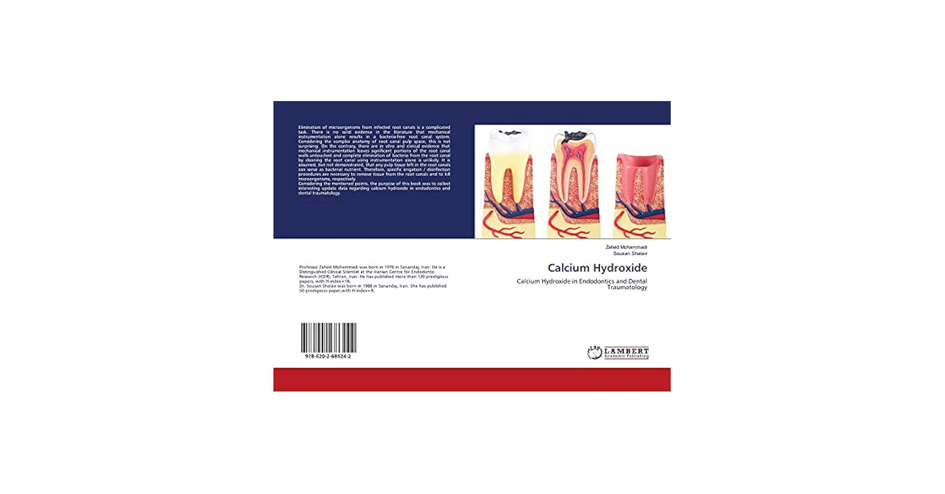 Calcium Hydroxide: Calcium Hydroxide in Endodontics and