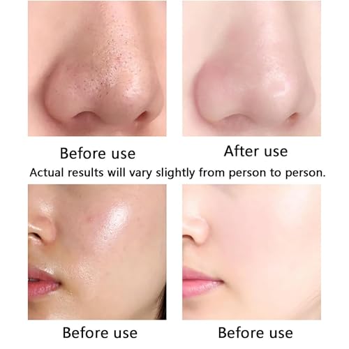 Hydrogen Oxygen Beauty Machine,10 in 1 Water Oxygen Hydra-Facial Machine with 8 Inch Display Screen,Quickly Decompose Water Molecules Deep Cleansing,for Beauty Salon