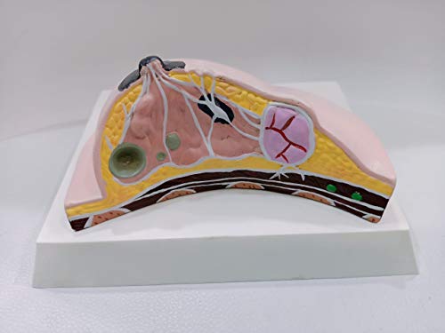 Image of Comprehensive Breast Pathology Model - High-Detail Anatomical Structure for Medical Education and Training