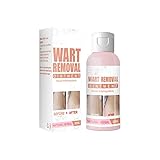 Wart Removal Ointment Natural Herbal Skin Tag, Ointment Instant Blemish Gel, Safe Effective Without Leaving Scars (1pc)
