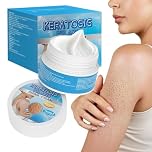 Vitamin E+10% Urea Keratosis Pilaris Cream, Strawberry Legs Treatment, Strawberry Skin Resurfacing & Smoothing Urea Body Cream For Chicken Skin, Exfoliating Moisturizer For Keratosis Pilaris, 30g