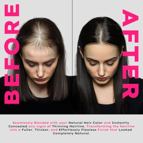 Image of WILDGLOW Korean Hairline Cover-Up Powder Black 10gm | Instantly Covers Grey Roots, Bald Spots, Beard & White Hair | Matte Finish & Long-Lasting | Highly Pigmented Flawless Hair Density Filler