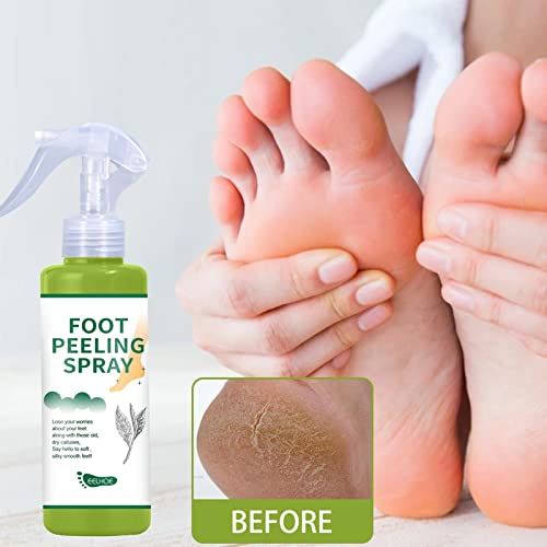 3 Pcs Esfoliante para os pés, Natural Hidratante Chá Verde Peeling Spray Removedor de Calosidades, S