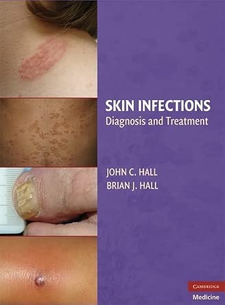 Skin Infections: Diagnosis and Treatment book cover