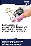 Raspolozhenie rentgenograficheskogo apexa i apikal'nogo otwerstiq w molqrah: DE
