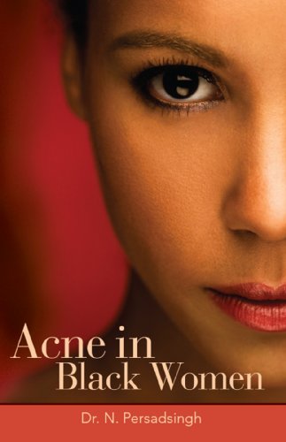 Acne in Black Women Acne in Black Women