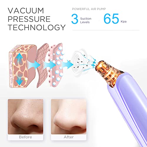 Diythinker FD-20 Blackhead Remover Pore Vacuum Cleaner thumb #1