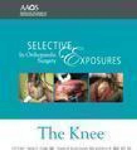 Selective Exposures in Orthopaedic Surgery: The Knee [DVD] [用品] Selective Exposures in Orthopaedic Surgery: The Knee: Amazon.ca