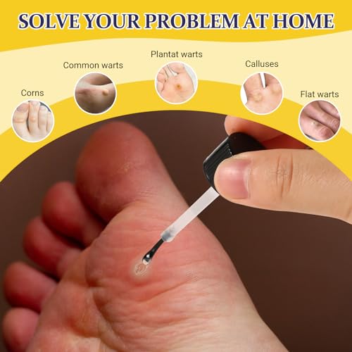ENERIDEA Wart & Corn Remover Liquid with Salicylic Acid, Fast Acting Wart Removal for Plantar Wart, Flat Wart, Common Wart, Corn, Callus - Thumbnail 3