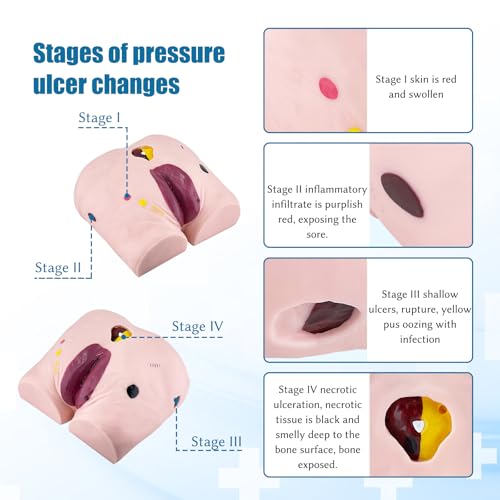 Image of JNMFTD Geriatric Decubitus Ulcer Nursing Model, 4 Stages Pressure Ulcers Advanced Nursing Elderly Bedsore Human Model Wound Kit with Product Manual Card for Hospital Medical Education Study