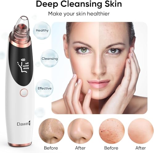 Daweir Blackhead Remover Pore Vacuum for Face and Nose, Facial Pore Cleanser with 3 Suction Levels, 5 Replaceable Tips, USB Rechargeable Tool for Blackheads and Whiteheads(White)