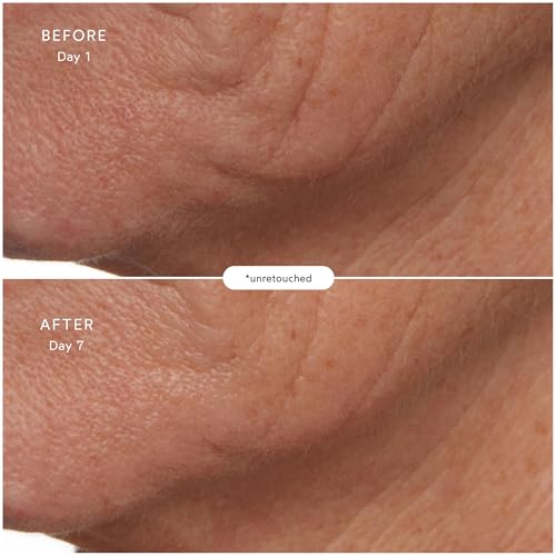 True Botanicals S-W-D-SEE4-R Natural Microbiome Enzyme Essence thumb #3