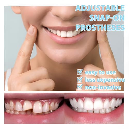 2 Pairs of Smiling Products Comfort can be Adjusted Freely, which can Quickly Restore self-Confidence. Adults can use The Upper and Lower Suits.