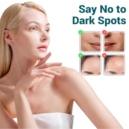 ARCHIDATE Dark Spot Remover Cream - Pigmentflecken entferner Gesicht Cream - Niacinamid Freckle Creme - Gesichtspflege Gesichtscreme Damen - Dunkle Flecken Entferner für Gesicht Feuchtigkeitscreme