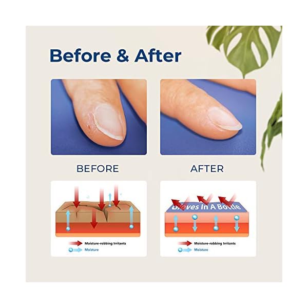 Gloves-In-A-Bottle-Shielding-Lotion-for-Dry-Skin-8-Ounce Gloves In A Bottle Shielding Lotion, Relief for Eczema and Psoriasis, 8 Fl Oz (Pack of 1)