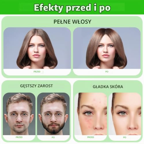 ALIIP Derma Stamp do mikronakłuwania, regulowany 0‑3 mm, 140 igieł, biały