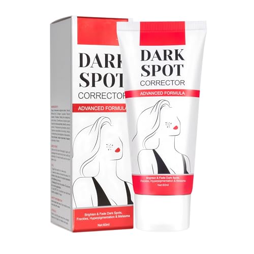 Crema para Eliminar Pecas, Lotion Antimanchas, Moisturizing Firming Cream, Hidrata y Nutre, Aclara Eficazmente las Manchas y da Luminosidad al Cutis, Apto para Todo Tipo de Pieles