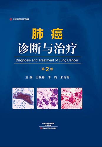 肺癌诊断与治疗 (Chinese Edition)