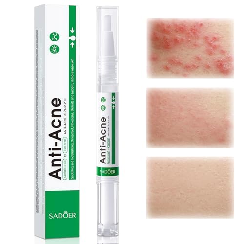 2ml Anti Acné Pen,Acne Facial Skincare Pen,Portable Facial Skincare Pens,Cuidado de la piel grasa y con tendencia al acné Pen,Cuidado facial diario