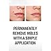 SkinPro Skin Tag Remover And Mole Corrector For Fast Removal Of Skin Moles, Skin Tags, Warts And Other Minor Growths, Medical Grade Formula with 17% Salicylic Acid (1 fl oz, 30 ml)
