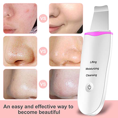 Hibeauty Skin Scrubber Face Spatula, Blackhead Remover Pore Cleansing, Comedones Extractor Exfoliator Facial Lifting Tool with 4 Modes for Facial Deep Cleansing - Thumbnail 2