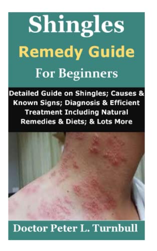 Shingles Remedy Guide for Beginners: Detailed Guide on Shingles; Causes & Known Signs; Diagnosis & Efficient Treatment Including Natural Remedies & Diets; & Lots More